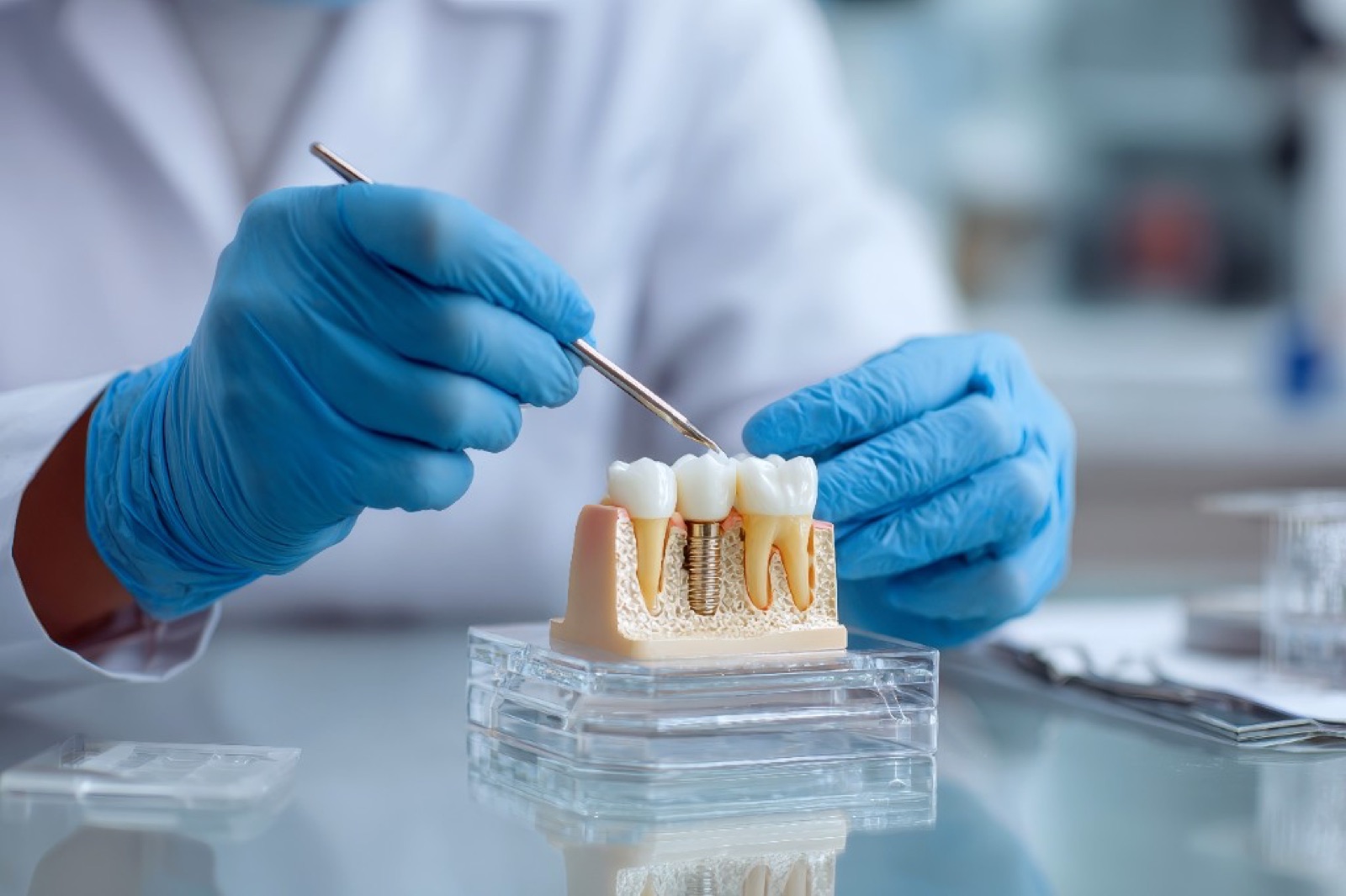 Dental implant model showing the screw and crown